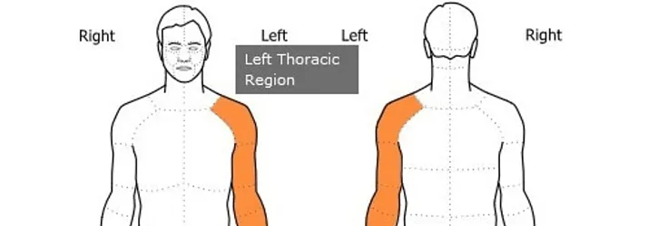 Diagnosis of Cervical Spinal Cord Multiple Sclerosis by a Chiropractic Physician: A Case Report