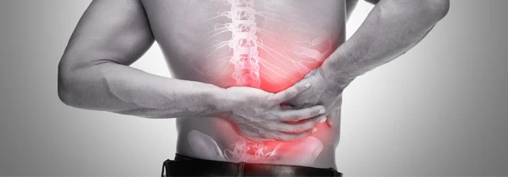 Immediate stroke following chiropractic cervical spine manipulation: a case report with causal analysis in Gilbert AZ